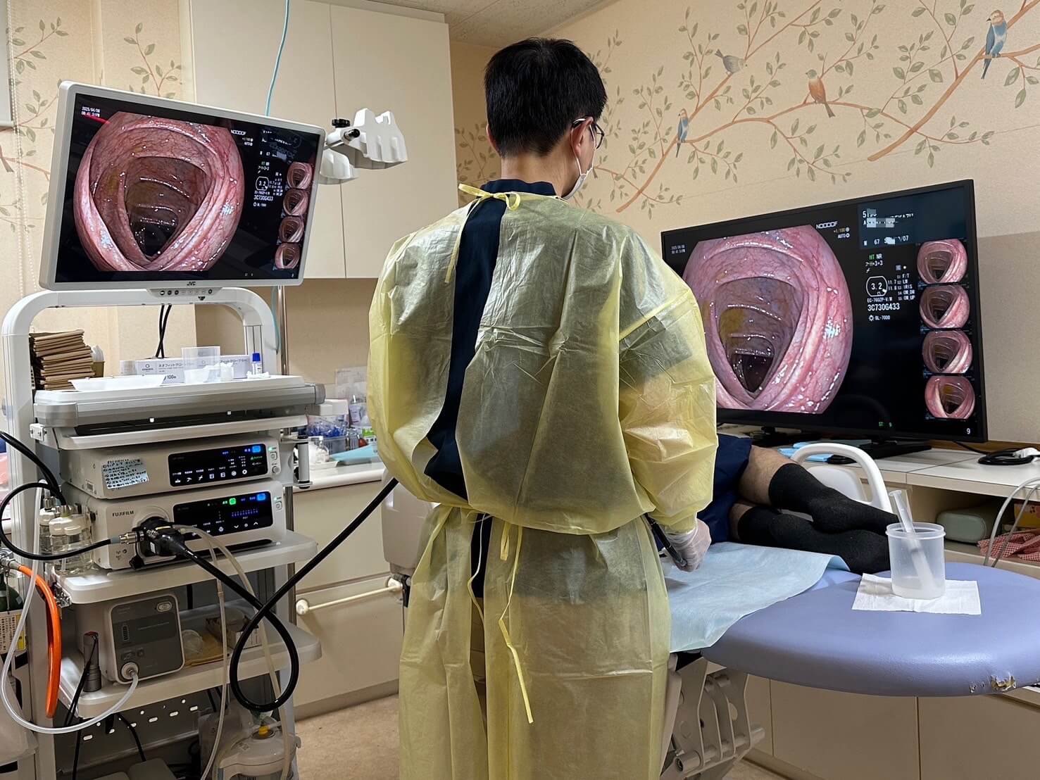 大腸の内視鏡検査をご希望の方へ